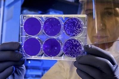 Evolution of Cell and Gene Therapies and the Role of Rapid Quality Control Solutions to Ensure Safe and Effective Products